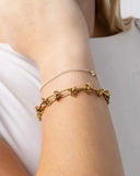 Knotted Chain Statement Bracelet